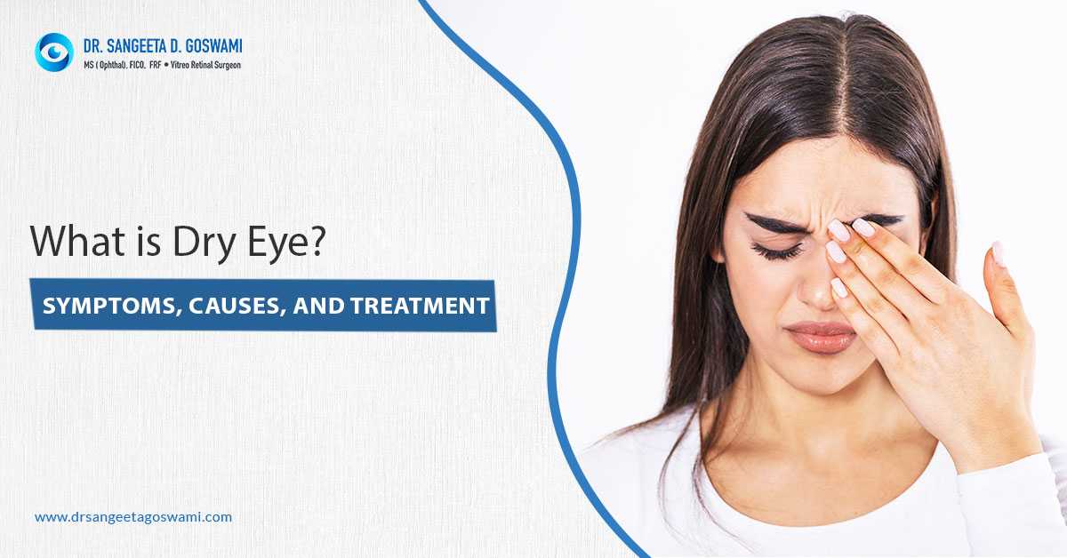 What Is Dry Eye? Symptoms, Causes, and Treatment